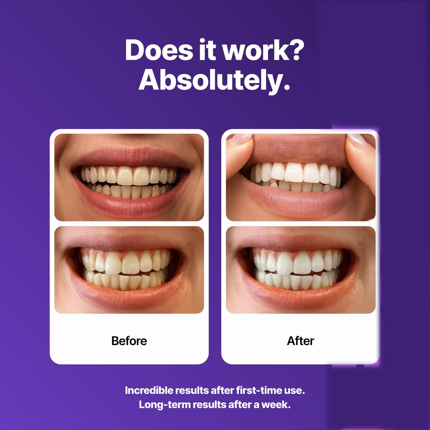 Avyel™ Violet Teeth Whitening Strips